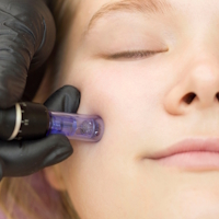 Kosmetikstudio ★ Schönheitssalon ★ Microneedling in Trebur  beauty by mel